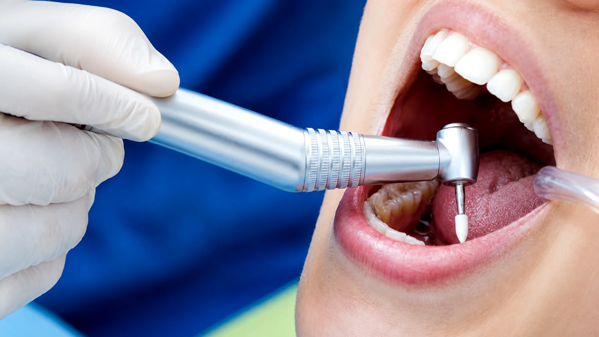 Complete Guide to Dental Treatment Services at Cure Bliss Indirapuram
