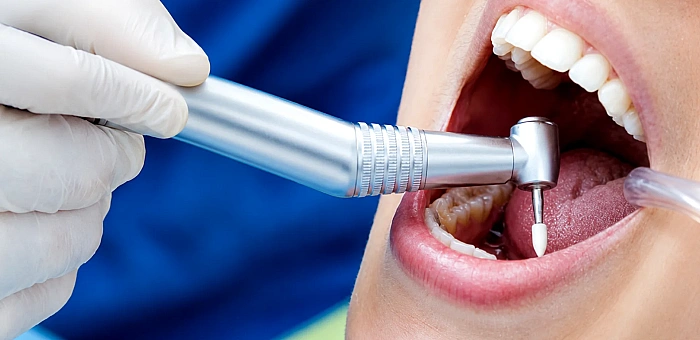 Complete Guide to Dental Treatment Services at Cure Bliss Indirapuram