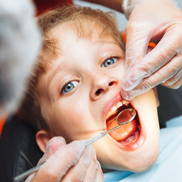 Childrens Dentistry Services in Indirapuram