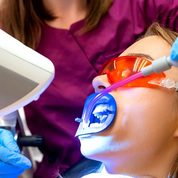 Fluoride Treatment Services in Indirapuram