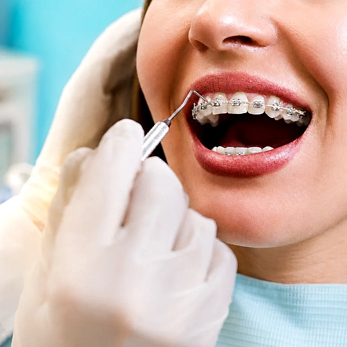 Orthodontic Services Manufacturers in Indirapuram