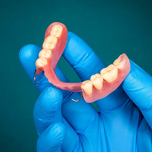 Partial Dentures Manufacturers in Indirapuram