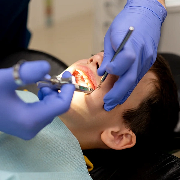Pit & Fissure Sealants Services in Indirapuram