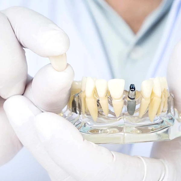 Prosthetic Services Services in Indirapuram