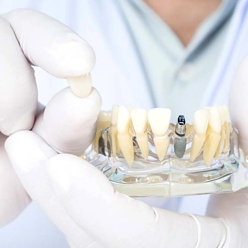 Prosthetic Services Manufacturers in Indirapuram