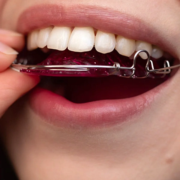 Retainers Services in Indirapuram