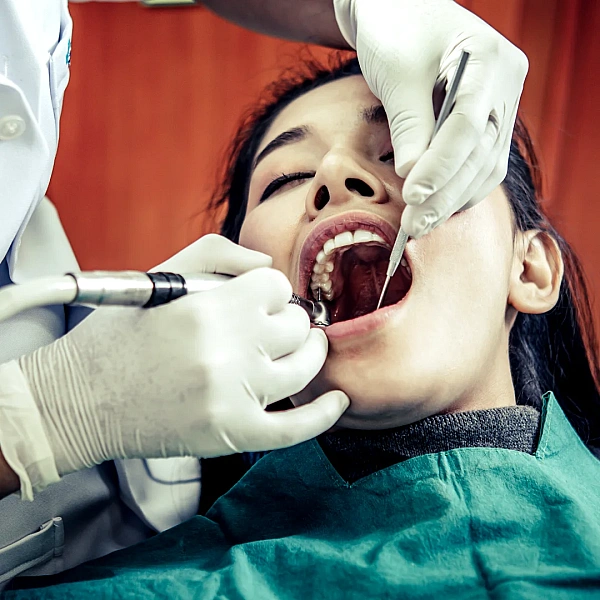 Routine Dental Checkup Services in Indirapuram