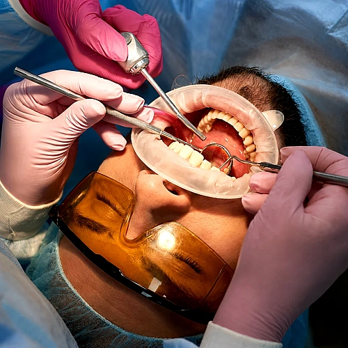 Surgical Services Manufacturers in Indirapuram