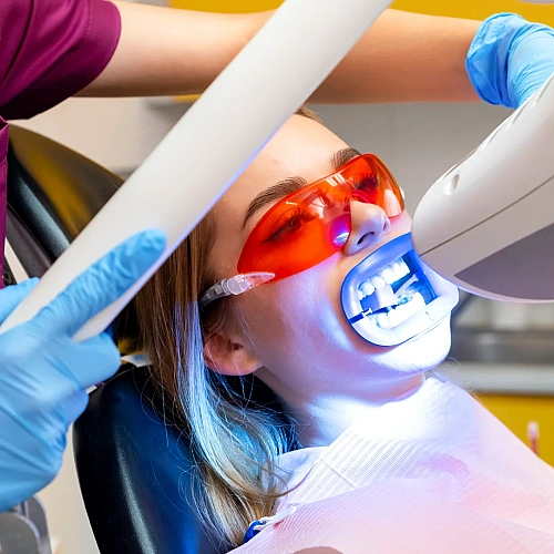 Teeth Whitening Manufacturers in Indirapuram