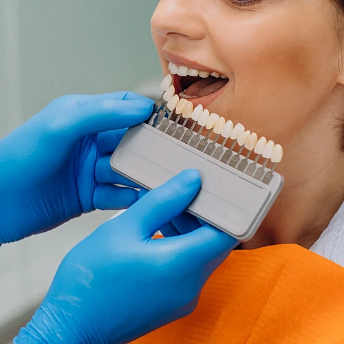 Tooth Bonding Manufacturers in Indirapuram